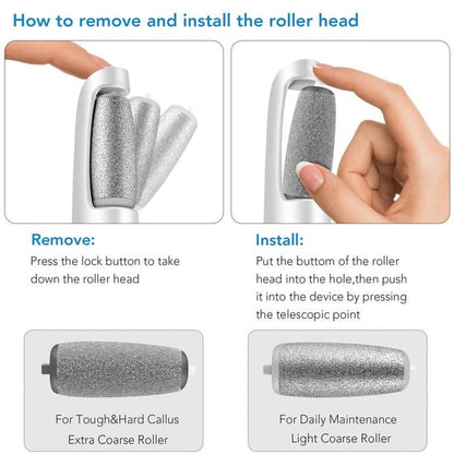 🔥Hot Sale - 53% OFF🔥Electric Feet Callus Remover – Smooth Skin in Seconds⚡