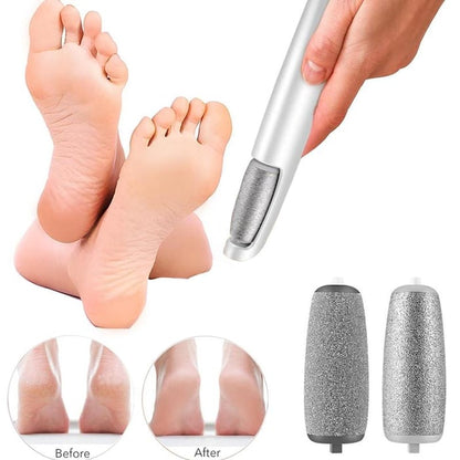 🔥Hot Sale - 53% OFF🔥Electric Feet Callus Remover – Smooth Skin in Seconds⚡